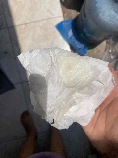 Keputihan normal atau tidak