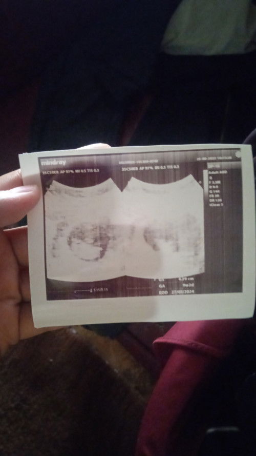 Kenapa ya ko bisa beda