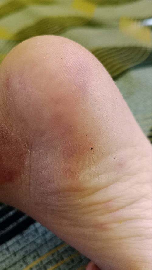 Bunda, anaknya ada yg pernah ngalamin kek gini gak?