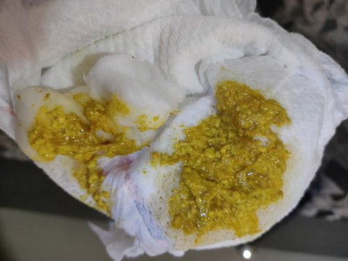 Formula fed poops