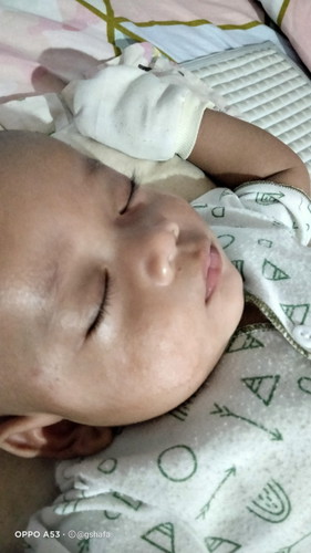 Bintik merah di pipi dan kepala bayi rekomendasi pakai obat apa ya bun biar cepet sembuh 🥺🙏