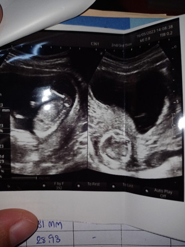 ทีม1พ.ย อยากรู้เพศลูก