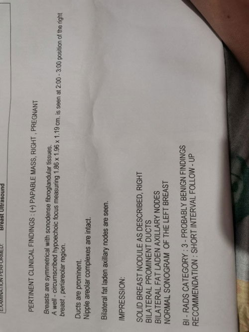 Palpable mass, Right