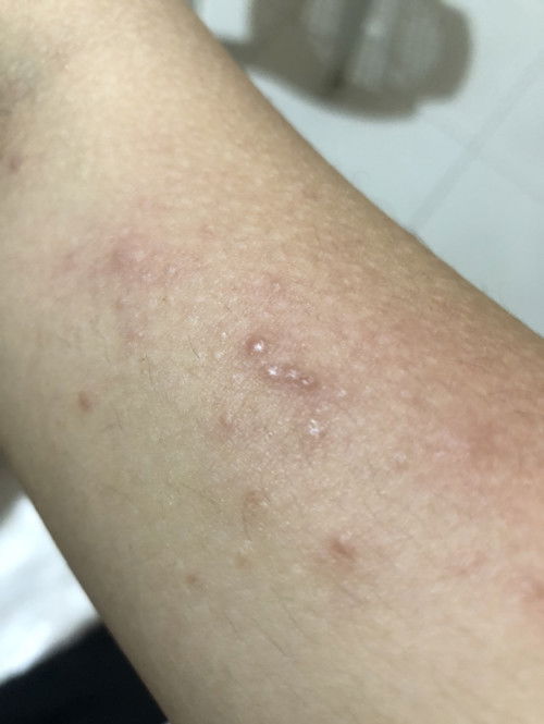 Pantal sa pagbubuntis