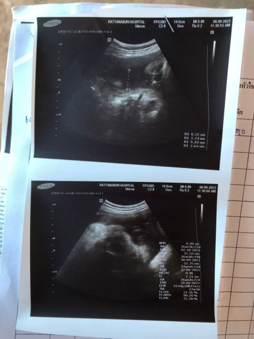 ลูกสาวคนแรกก