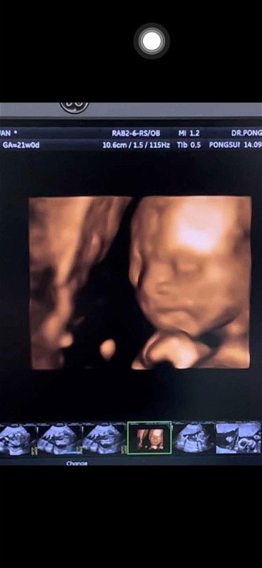 อวดภาพอัลตราซาวด์กันค่ะแม่ๆ