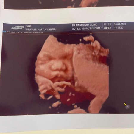 น้อง 30+2 น้ำหนัก 1,636 กก. กลับหัวแล้ว