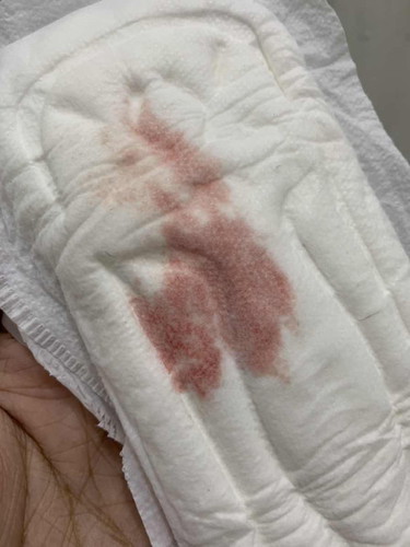 Is it normal to have light bleeding at the early week of pregnancy?