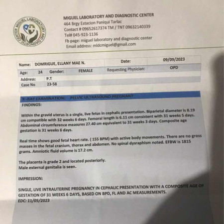 Hello mga mi ok lng po b ung ultrasound result ko hnd p po kc ako nkkapunta sa center eh