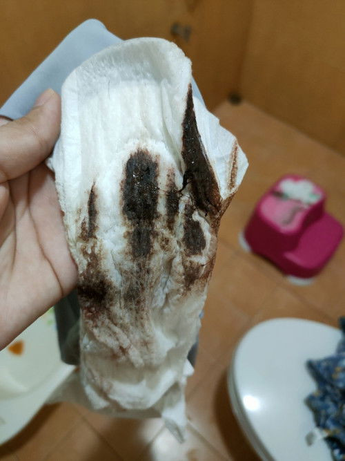 ย้ำคาวปลาสีแลบนี้ผิดปกติมั้ยคะ