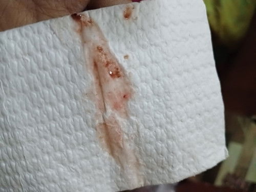 Flek di usia kehamilan 6 Minggu bahaya ngga