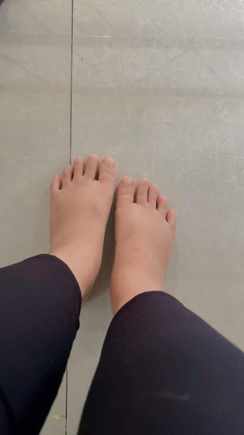 bun 17minggu, kaki udah bengkak apakah normal ya? ada yg sama?