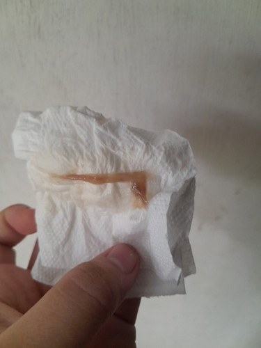 สอบถามค่ะถ้าแบบนี้ปกติไหม