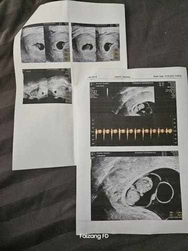 ในแอป 10 w แต่ซาว์ด 9+1 w