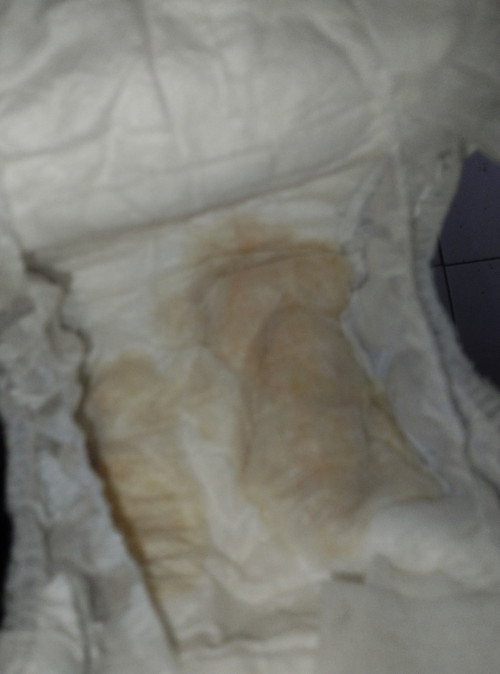 Kenapa ya urin berwarna kecokelatan gini?