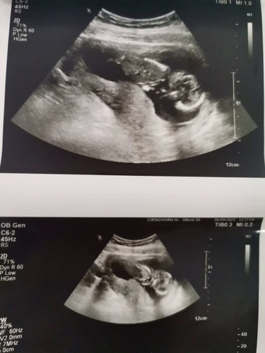 ทายเพศลูก💖💖💖