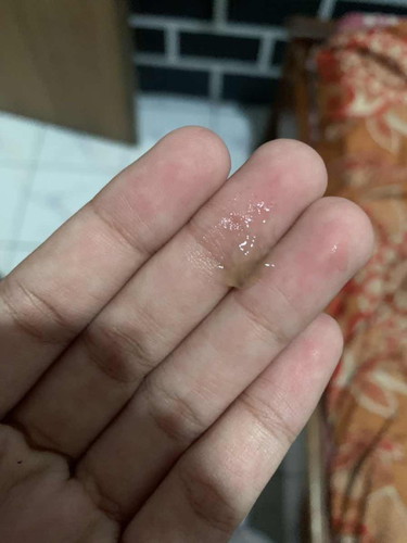 Hamil 38minggu keluar lendir