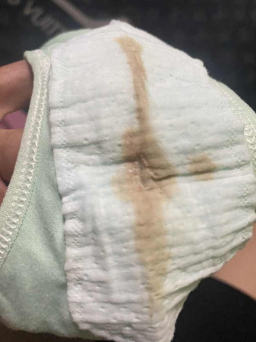 Bunda bunda mau tanya dong kalo keluar flek coklat gitu kenapa ya di usia kandungan 35minggu