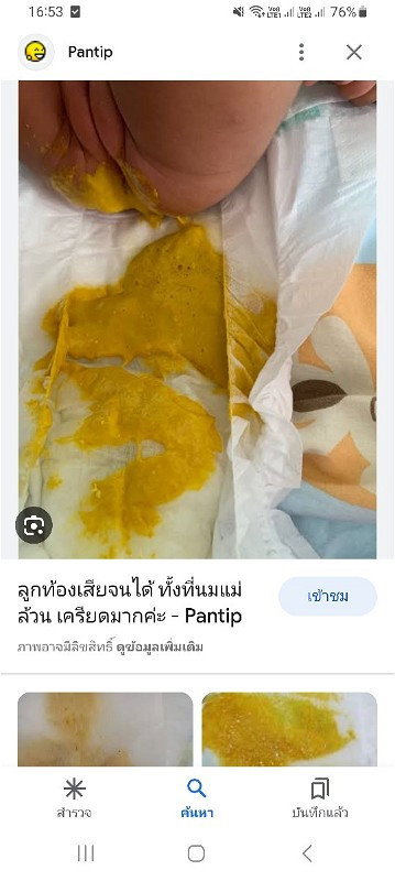 ลูกกินนมผงตราหมีถ่ายเหลวแบบนี้วันล่ะ1-2ครั้งต่อวันปกติไหมค่ะ
