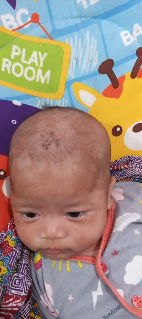 Ada yg pernah kyk gini ga bun