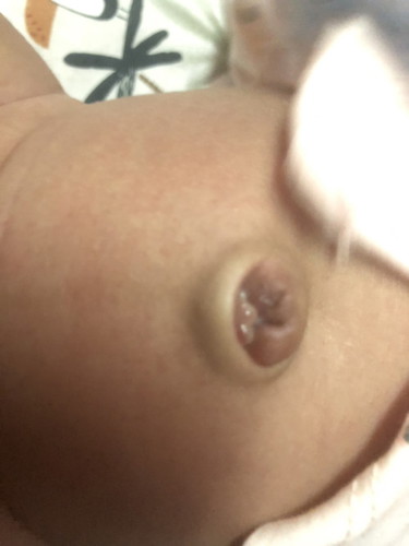 pusat baby
