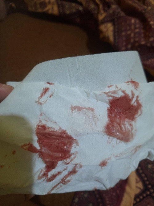 Flek sudah 7hari masih keluar