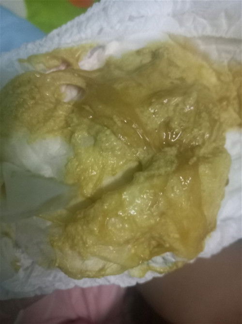 ขอโทษที่ลงรูปไม่สุภาพนะคะ