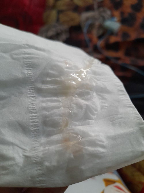 Cairan keputihan seperti ada samar samar warna darah