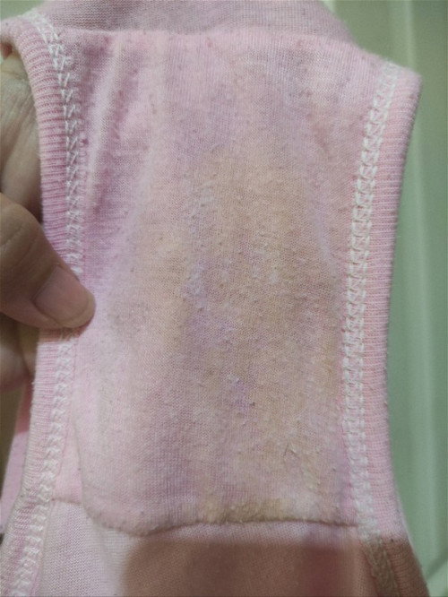 Yellow stain/discharge