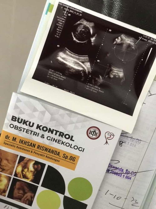 Bund tips biar janin cepat masuk ke jln lahir