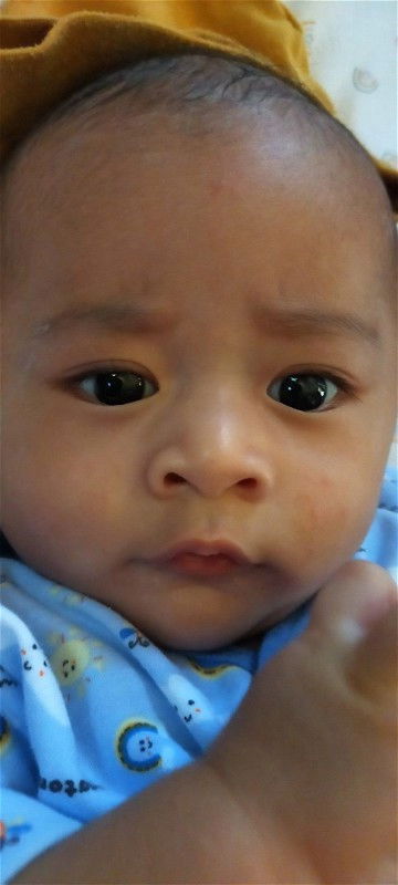 Wajah bayi bintik-bintik merah