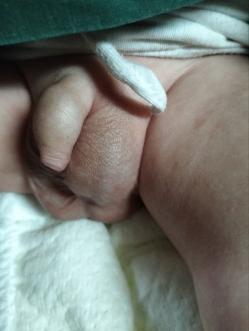 Ask lang po mga mamsh