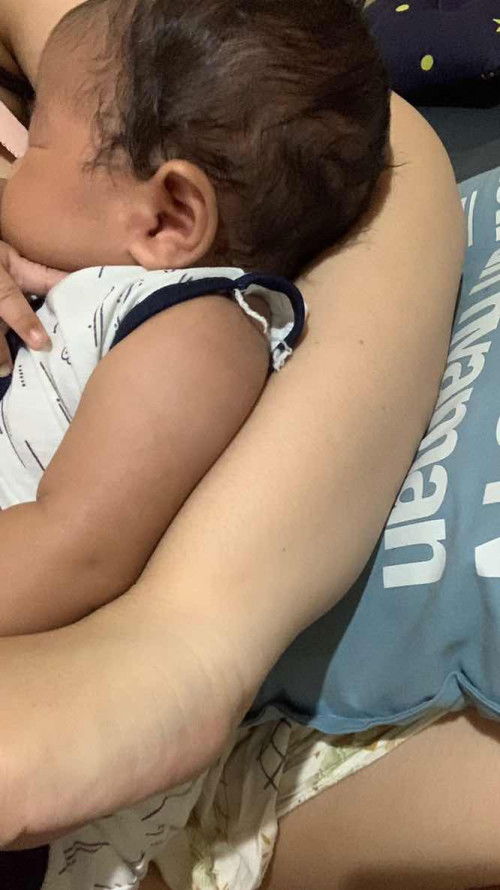 Warna Kulit Bayi 1.5bulan