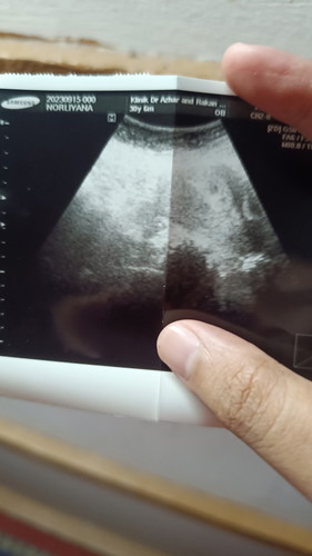 6minggu 2 hari...scan pembentukan janin tk berapa bulat elok