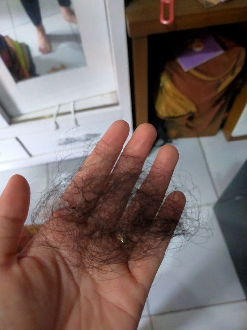 Rambut rontok ketika hamil 11W