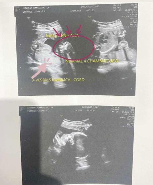 แม่แม่ช่วยพิจารณาทีค่ะว่าเพศชายจริงๆหรอคะ