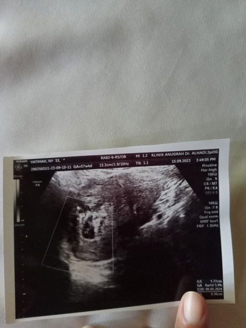 Hamil 7 wk janin belum terlihat