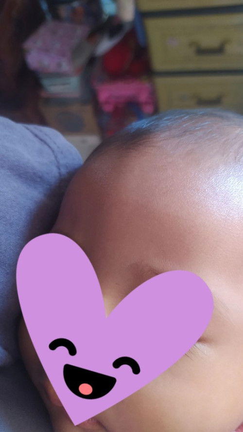 Tulang menonjol di dahi