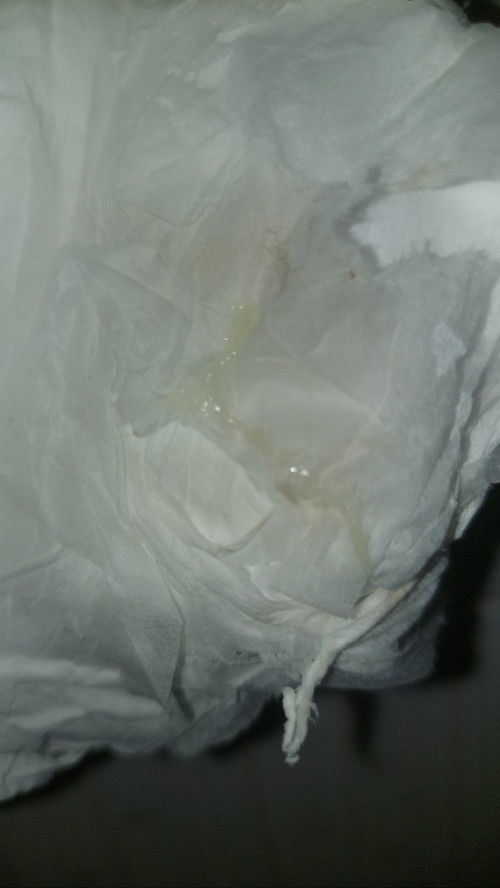 Lendir melahirkan 39 minggu