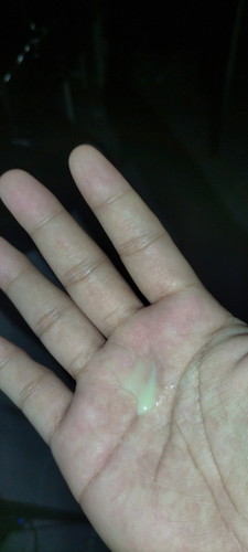 Tanong lang mga mi,discharge