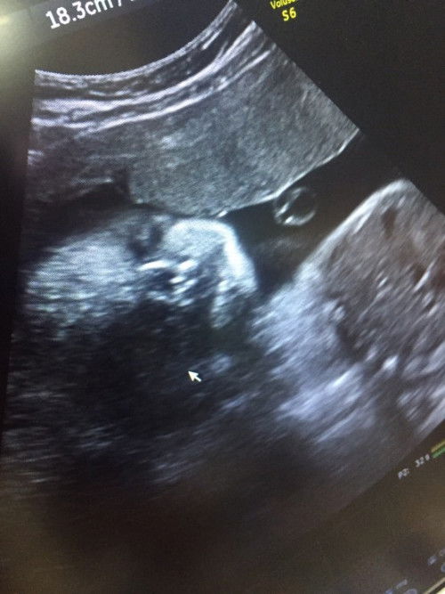 น้ำหนักขึ้นเยอะมาก