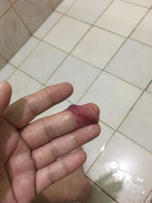 38 weeks. Ano po kaya ung ganito na lumalabas? Lalabas na po kaya si baby nito?