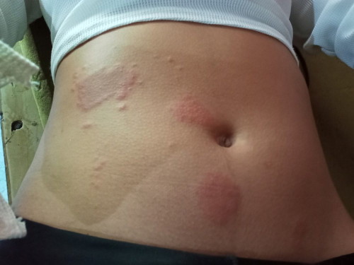 ANONG GAMOT NITO???7WEEKS PREGGY PO AKO