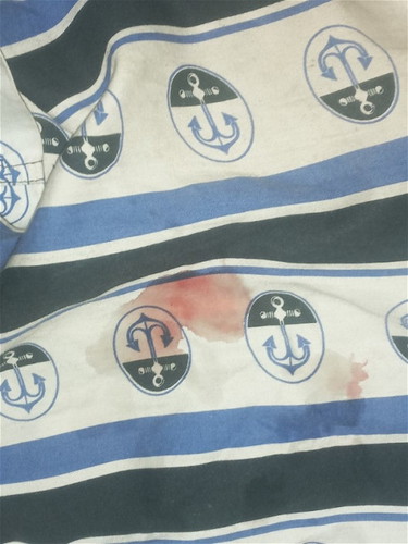 #เลือดออกช่องคลอด