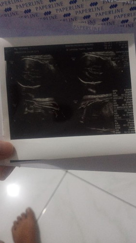 Mau tanya tentang hpl yang mana yah karena ada 4 tanggal