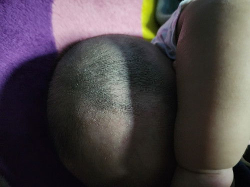 น้อง3เดือน10วัน