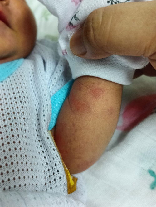 Bayi baru berusia 5 hari