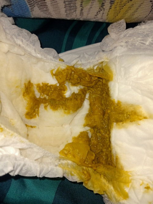 Maaf agak jorok bund' normalkah pup bayi berwarna agak hijau begini??? Full asi