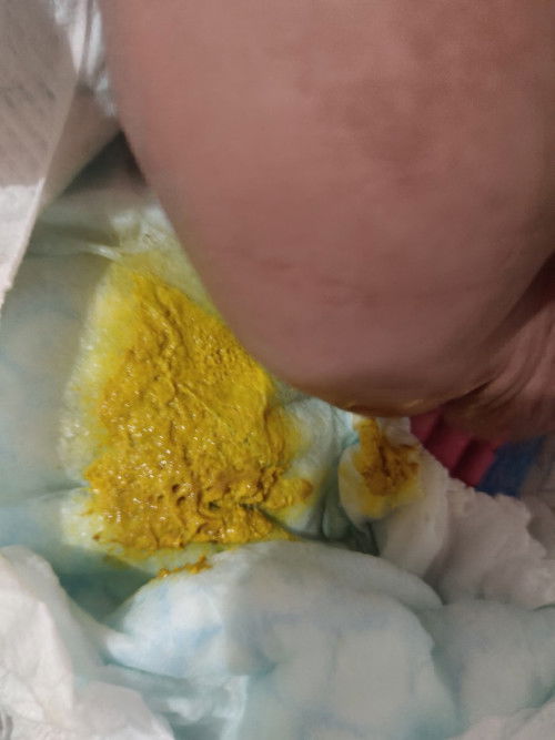 5 weeks old si baby. And pansin ko nakakailang popo siya