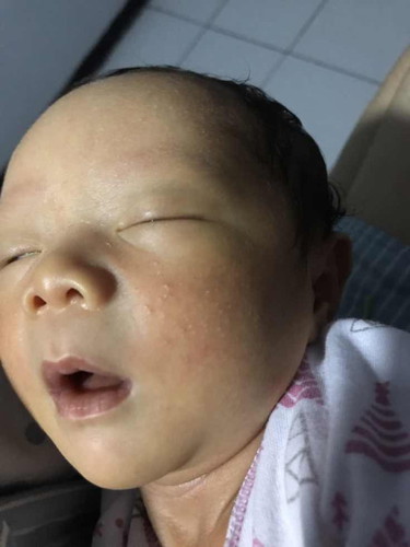 Pipi bayi bintik